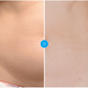 Image for article titled You Can Freeze Your Fat and Poop It Out